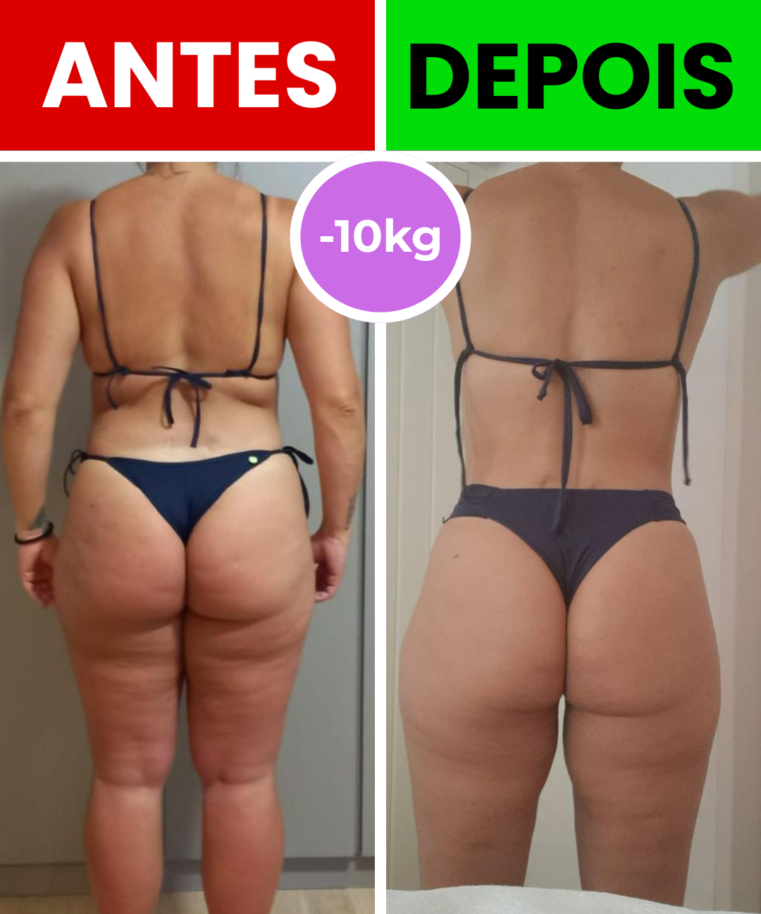Antes e depois — caso 2